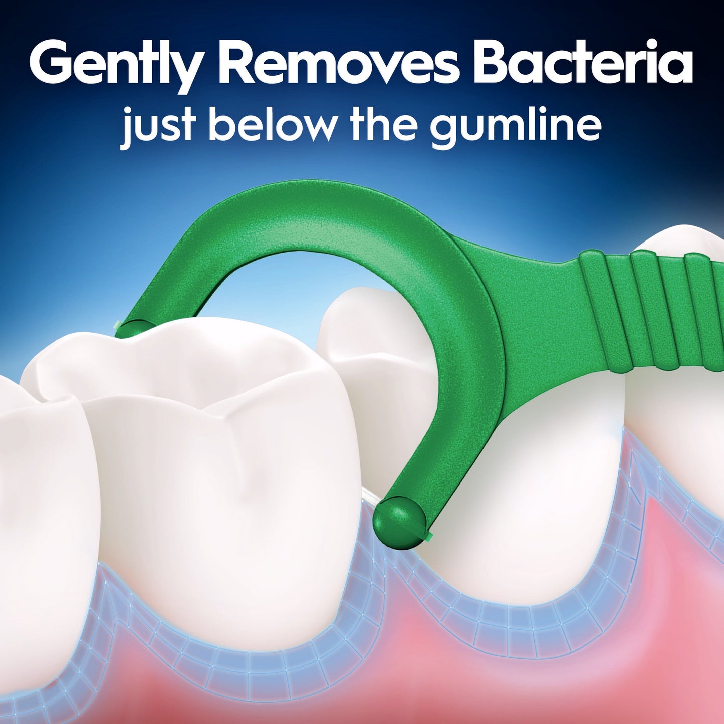 Green dental tool near teeth with text about removing bacteria below the gumline on a blue and white background.