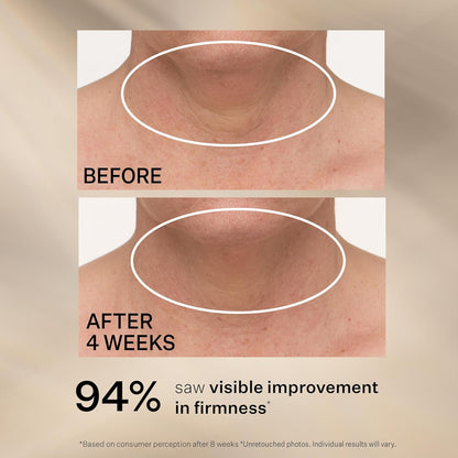 StriVectin TL Advanced Tightening Neck Cream PLUS w/ Alpha-3 Peptide, 30 ml / 1 FL OZ [12M]