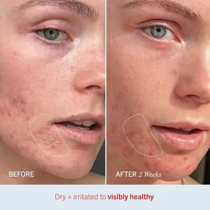 First Aid Beauty Ultra Repair Cream, 56.7 g (2 oz) [12M]